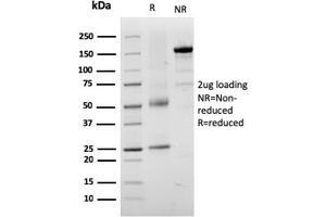 SDS-PAGE Analysis Purified TYRP1-Monospecific Mouse Monoclonal Antibody (TYRP1/3282). (Tyrosinase-Related Protein 1 抗体  (AA 257-377))