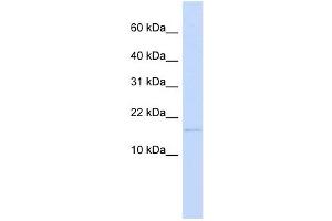 C3ORF18 antibody used at 1 ug/ml to detect target protein. (C3orf18 抗体  (N-Term))