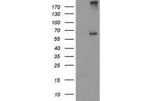 HEK293T cells were transfected with the pCMV6-ENTRY control (Left lane) or pCMV6-ENTRY RPN1 (Right lane) cDNA for 48 hrs and lysed. (RPN1 抗体)