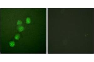 Immunofluorescence analysis of HuvEc cells, using Cyclin E1 (Ab-395) Antibody. (Cyclin E1 抗体  (AA 361-410))