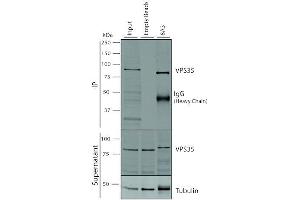 Immunoprecipitation analysis using Mouse Anti-VPS35 Monoclonal Antibody, Clone 8A3 (ABIN6932968). (VPS35 抗体  (Biotin))