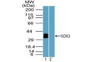Image no. 1 for anti-SRY (Sex Determining Region Y)-Box 2 (SOX2) (AA 100-150) antibody (ABIN1490795) (SOX2 抗体  (AA 100-150))