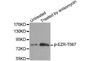 Western blot analysis of extracts from MDA cells, using Phospho-EZR-T567 antibody (ABIN2987611). (Ezrin 抗体  (pThr567))