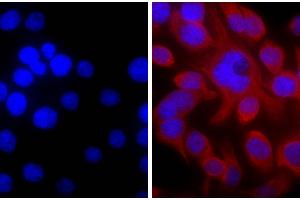 Human pancreatic carcinoma cell line MIA PaCa-2 was stained with Mouse Anti-Cytokeratin 18-UNLB and DAPI. (山羊 anti-小鼠 IgG (Heavy & Light Chain) Antibody (TRITC) - Preadsorbed)