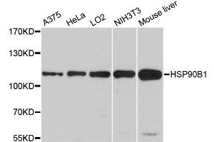 Western blot analysis of extracts of various cell lines, using HSP90B1 antibody (ABIN5970377) at 1/1000 dilution. (GRP94 抗体)
