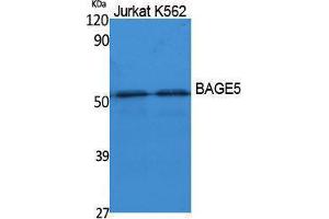 Western Blotting (WB) image for anti-B Melanoma Antigen Family, Member 5 (BAGE5) (N-Term) antibody (ABIN3178093) (BAGE5 抗体  (N-Term))