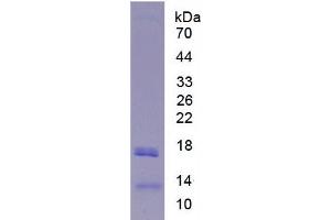 SDS-PAGE analysis of Human Lipase, Hepatic Protein. (LIPC 蛋白)