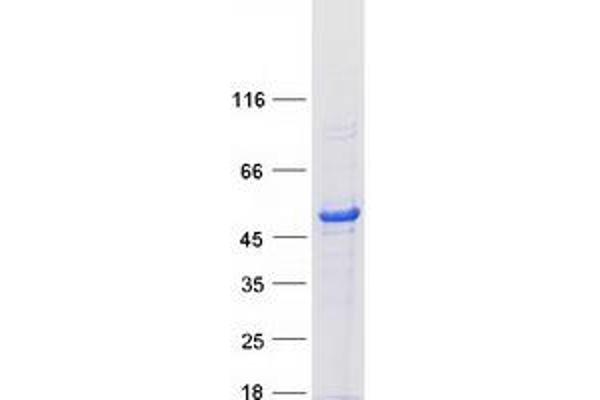 CHN1 Protein (Transcript Variant 2) (Myc-DYKDDDDK Tag)