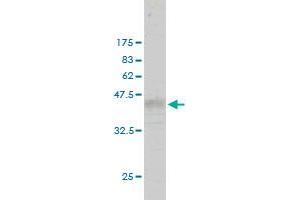 Western Blot detection against Immunogen (37. (RASA3 抗体  (AA 725-834))