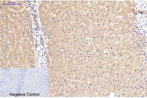 Immunohistochemical analysis of paraffin-embedded human liver tissue. (beta Catenin 抗体)