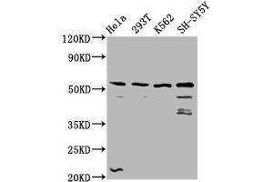Western Blot Positive WB detected in: Hela whole cell lysate, 293T whole cell lysate, K562 whole cell lysate, SH-SY5Y whole cell lysate All lanes: RUFY3 antibody at 3. (RUFY3 抗体  (AA 243-352))