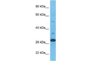 Host:  Rabbit  Target Name:  ELOV1  Sample Type:  Stomach Tumor lysates  Antibody Dilution:  1. (ELOVL1 抗体  (N-Term))