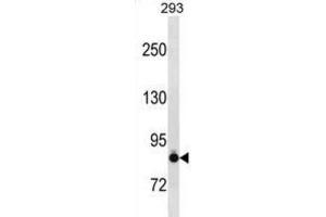 Western Blotting (WB) image for anti-K-Cadherin (CDH6) antibody (ABIN2997776) (CDH6 抗体)