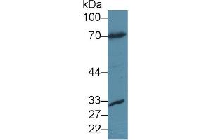 Western blot analysis of Mouse Liver lysate, using Rabbit Anti-Human FOXO1 Antibody (2 µg/ml) and HRP-conjugated Goat Anti-Rabbit antibody (abx400043, 0. (FOXO1 抗体  (AA 333-557))