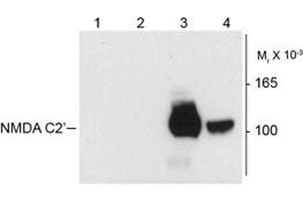 NMDA 1 Receptor 抗体  (Splice Variant C2')