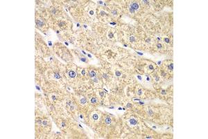Immunohistochemistry of paraffin-embedded human liver injury using ACADS antibody (ABIN5970342) at dilution of 1/100 (40x lens). (ACADS 抗体)
