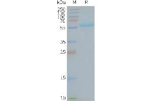 Human MA-Nanodisc, Flag Tag on SDS-PAGE (TMEM180 蛋白)