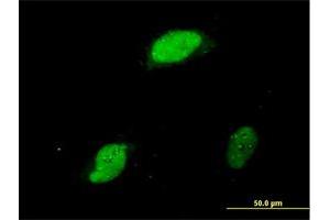Immunofluorescence (IF) image for anti-Early Growth Response 1 (EGR1) (AA 444-543) antibody (ABIN560707)