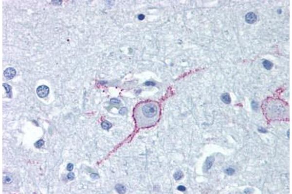 GALR3 抗体  (Extracellular Domain)