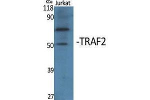 Western Blotting (WB) image for anti-TNF Receptor-Associated Factor 2 (TRAF2) (Internal Region) antibody (ABIN3177779) (TRAF2 抗体  (Internal Region))