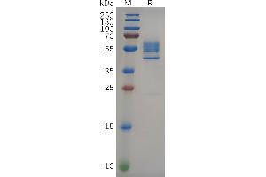 DR3/LARD Protein (AA 25-199) (Fc Tag)