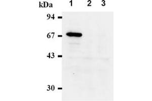 Western Blotting (WB) image for anti-Checkpoint Kinase 2 (CHEK2) antibody (ABIN487488) (CHEK2 抗体)