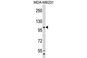 Image no. 1 for anti-Complement Component 6 (C6) (N-Term) antibody (ABIN452791) (C6 抗体  (N-Term))