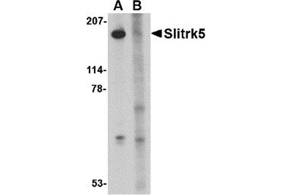 SLITRK5 抗体  (Middle Region 2)