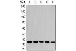 Western blot analysis of THOC1 expression in SHSY5Y (A), SW620 (B), NIH3T3 (C), mouse spleen (D), rat liver (E) whole cell lysates. (THOC1 抗体)