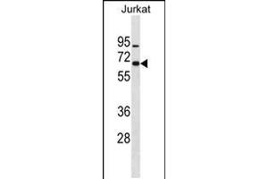 Western blot analysis in Jurkat cell line lysates (35ug/lane). (ZNF358 抗体  (N-Term))