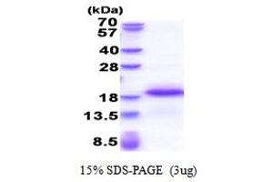 EAF1 Protein (AA 182-268) (His tag)