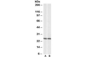 Western blot testing of mouse [A] and rat [B] brain lysate with UCHL1 antibody at 0. (UCHL1 抗体)