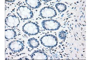 Immunohistochemical staining of paraffin-embedded colon tissue using anti-CHEK2mouse monoclonal antibody. (CHEK2 抗体)