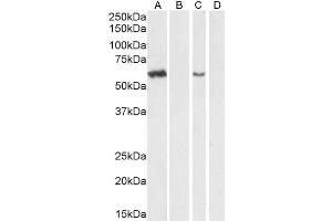 Western Blotting (WB) image for anti-Arylsulfatase A (ARSA) (Internal Region) antibody (ABIN238536)