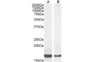 Western Blotting (WB) image for anti-Peripheral-Type Benzodiazepine Receptor (TSPO) (C-Term) antibody (ABIN570960)