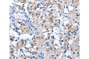 Immunohistochemistry (IHC) image for anti-Ankyrin Repeat and SOCS Box-Containing 2 (ASB2) antibody (ABIN2422959) (ASB2 抗体)