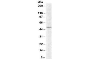 Western blot testing of K562 lysate with TRIP6 antibody at 2ug/ml. (TRIP6 抗体)