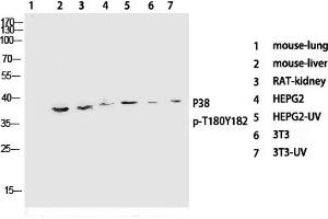 Western Blotting (WB) image for anti-Mitogen-Activated Protein Kinase 14 (MAPK14) (pThr180), (pTyr182) antibody (ABIN5955628) (MAPK14 抗体  (pThr180, pTyr182))