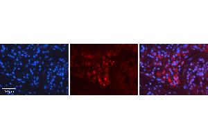Rabbit Anti-RET Antibody Catalog Number: ARP30878_P050 Formalin Fixed Paraffin Embedded Tissue: Human Testis Tissue Observed Staining: Cytoplasm Primary Antibody Concentration: 1:600 Other Working Concentrations: N/A Secondary Antibody: Donkey anti-Rabbit-Cy3 Secondary Antibody Concentration: 1:200 Magnification: 20X Exposure Time: 0. (Ret Proto-Oncogene 抗体  (C-Term))