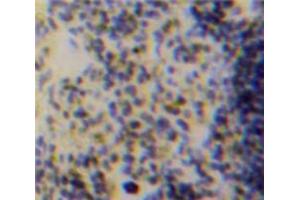 Used in DAB staining on fromalin fixed paraffin-embedded Spleen tissue (ACP5 抗体  (AA 28-286))