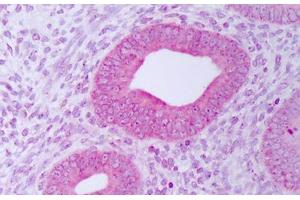 Anti-PDIA3 / ERp57 antibody IHC staining of human uterus, endometrium. (PDIA3 抗体)