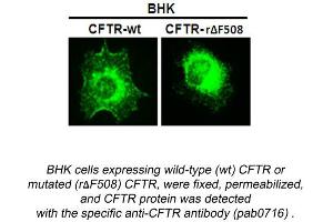 Image no. 1 for anti-Cystic Fibrosis Transmembrane Conductance Regulator (ATP-Binding Cassette Sub-Family C, Member 7) (CFTR) (N-Term) antibody (ABIN559719) (CFTR 抗体  (N-Term))