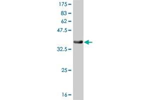 Western Blot detection against Immunogen (36. (TXK 抗体  (AA 131-230))