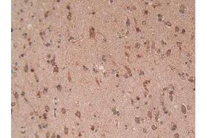 IHC-P analysis of Human Brain Tissue, with DAB staining. (EZH2 抗体  (AA 51-285))