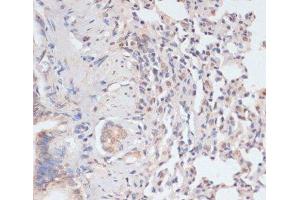Immunohistochemistry of paraffin-embedded Rat lung using Phospho-STAT1(S727) Polyclonal Antibody at dilution of 1:100 (40x lens). (STAT1 抗体  (pSer727))