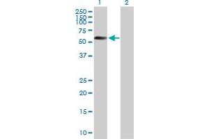 Western Blot analysis of STK11 expression in transfected 293T cell line by STK11 MaxPab polyclonal antibody. (LKB1 抗体  (AA 1-433))