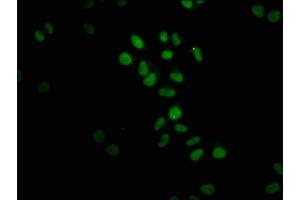 Immunofluorescence (IF) image for anti-Fat Mass and Obesity-Associated (FTO) antibody (ABIN7127502)