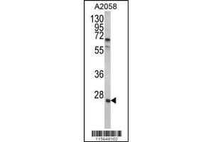 Western blot analysis of GRB2 Antibody in A2058 cell line lysates (35ug/lane) (GRB2 抗体  (AA 89-118))