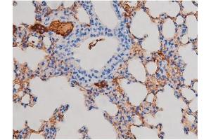 ABIN6267471 at 1/200 staining Mouse lung tissue sections by IHC-P. (AKT1 抗体  (pSer124))