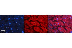 Rabbit Anti-SF3B1 Antibody   Formalin Fixed Paraffin Embedded Tissue: Human heart Tissue Observed Staining: Cytoplasmic Primary Antibody Concentration: 1:100 Other Working Concentrations: 1:600 Secondary Antibody: Donkey anti-Rabbit-Cy3 Secondary Antibody Concentration: 1:200 Magnification: 20X Exposure Time: 0. (SF3B1 抗体  (N-Term))